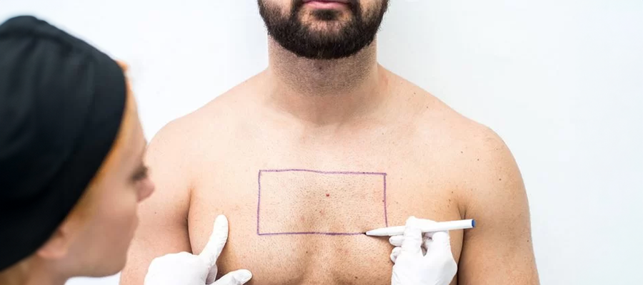 bodyhair